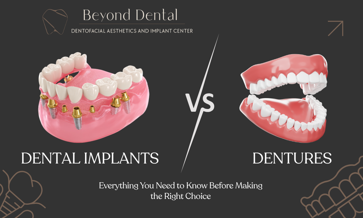 Dental Implants vs. Dentures A Complete Guide to Choosing the Right Option
