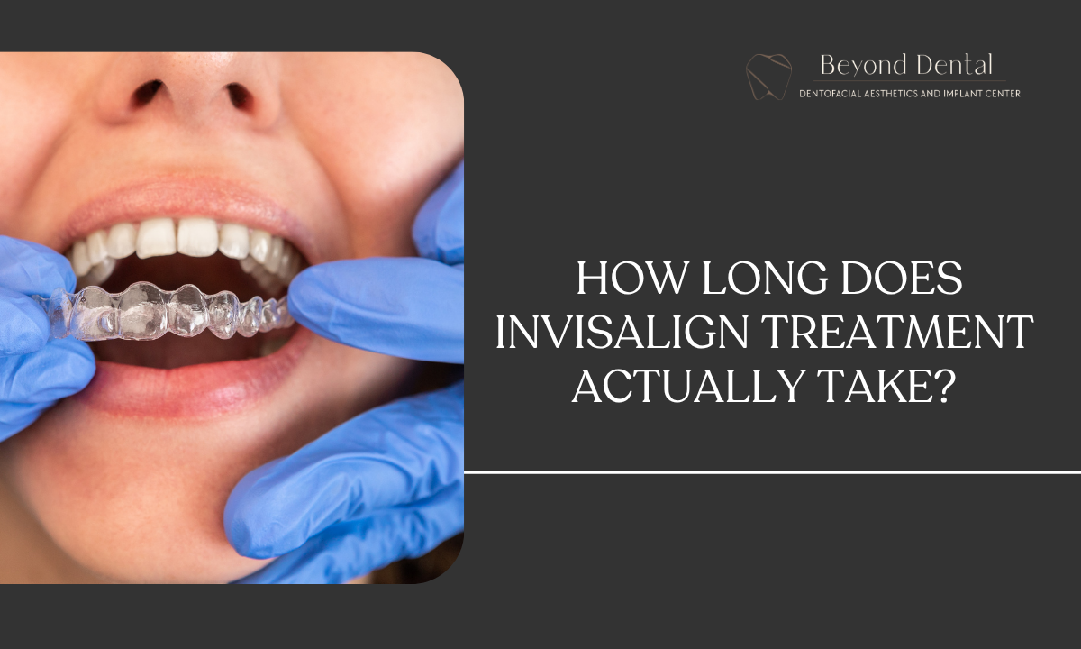 How Long Does Invisalign Treatment Actually Take?