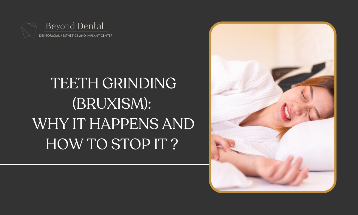 what is bruxism ?