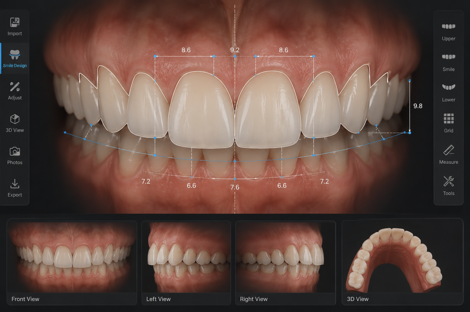 3D Smile Design
