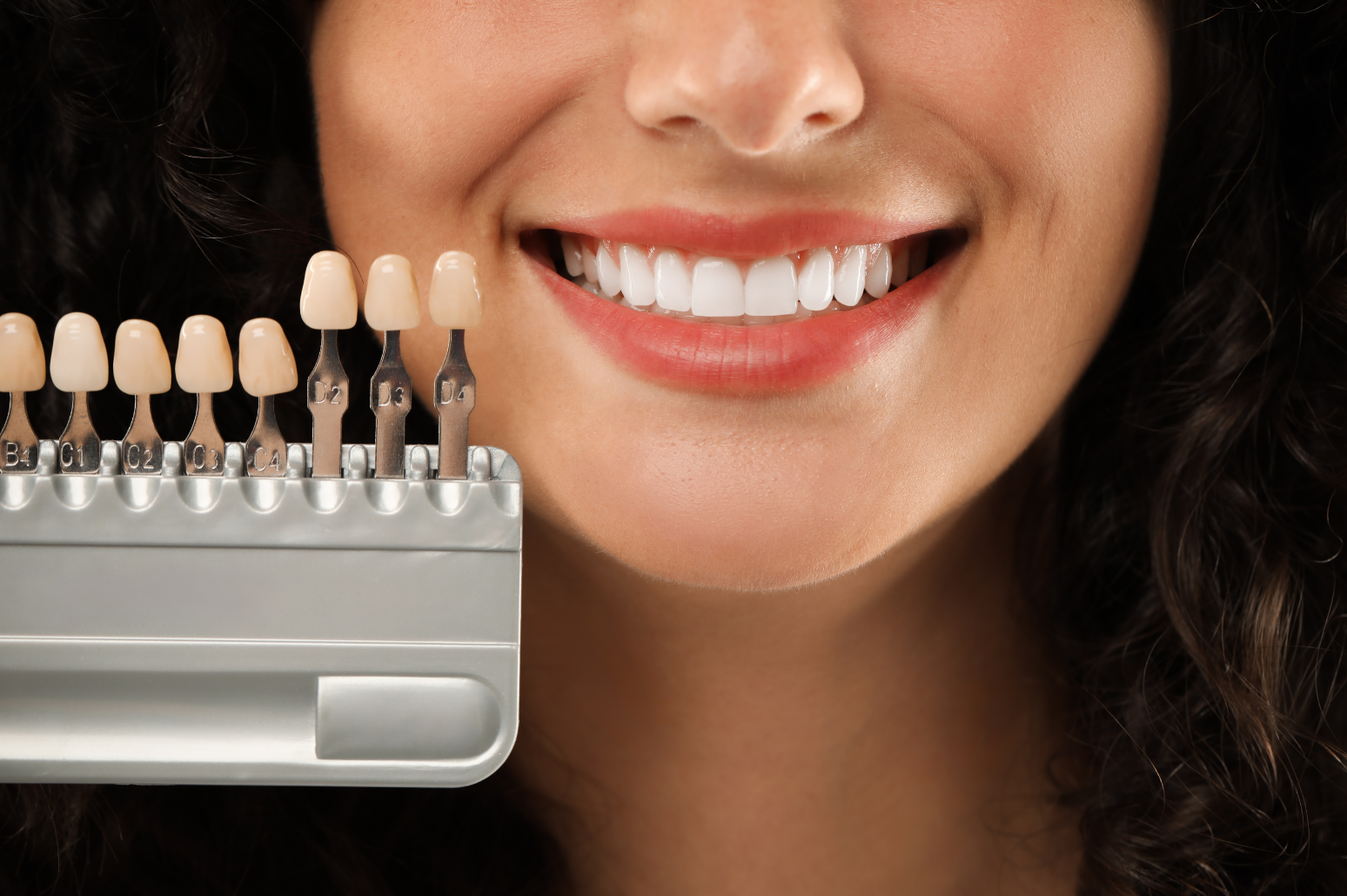 Porcelain and Composite Veneers