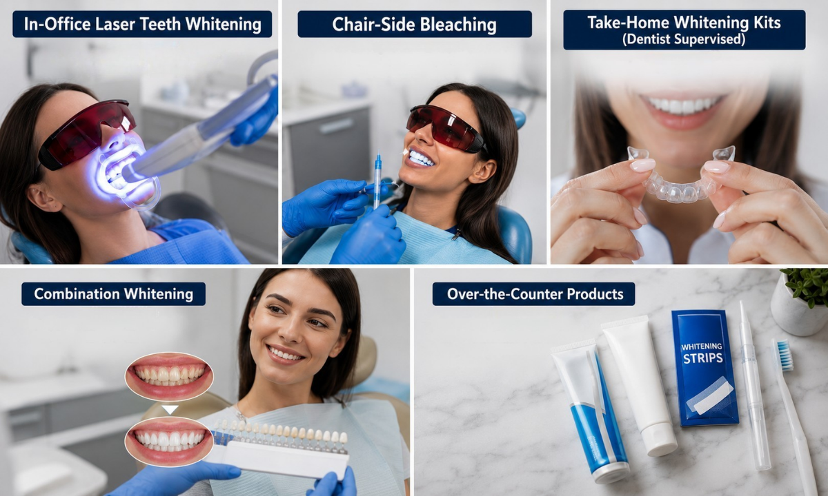 Teeth Whitening Options
