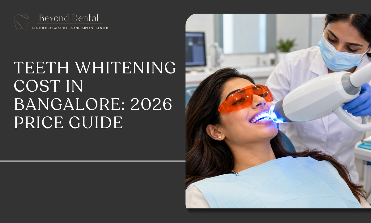 Bangalore Teeth Whitening Cost