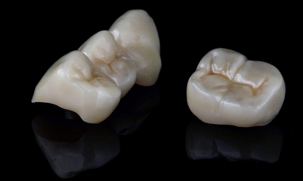 what are dental crowns? 