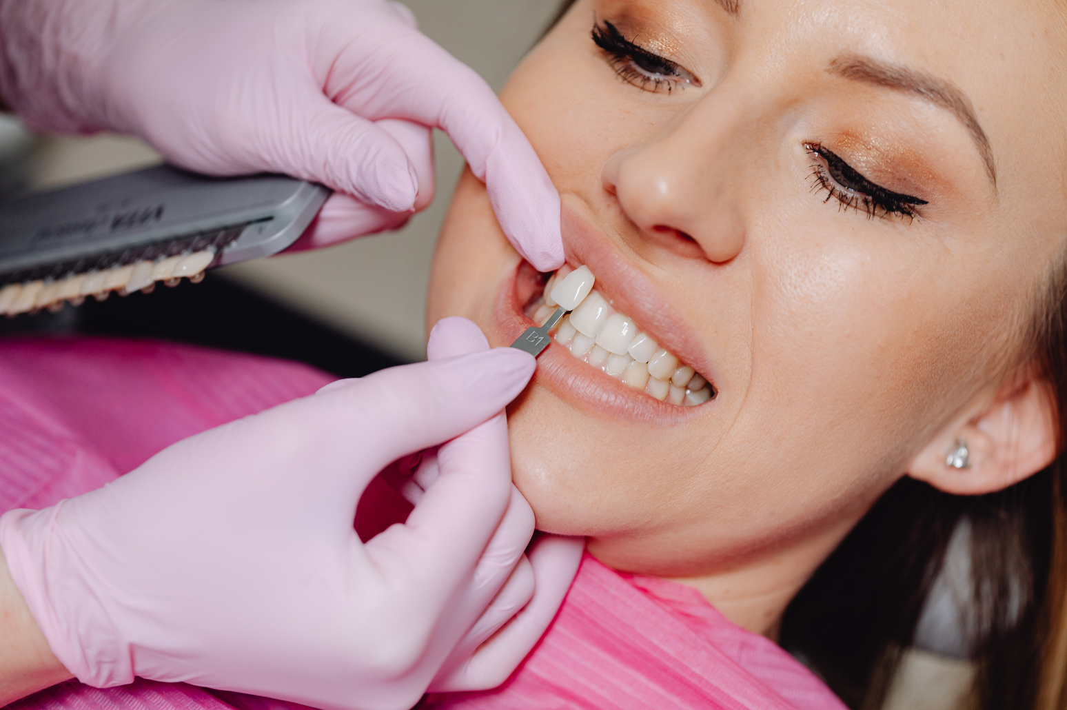Dental Veneers In Vasanth Nagar, Bangalore