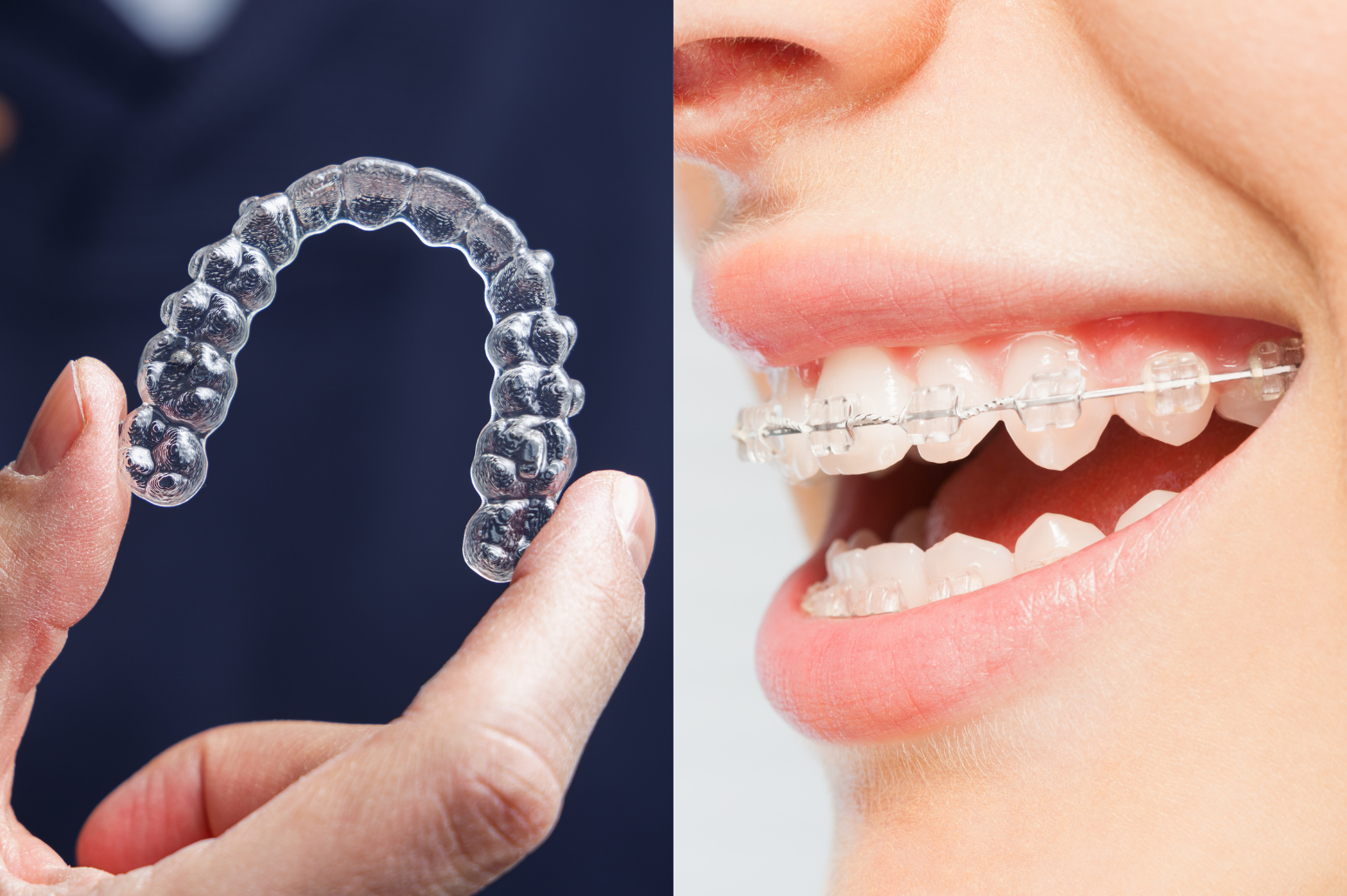 invasilgn and braces
