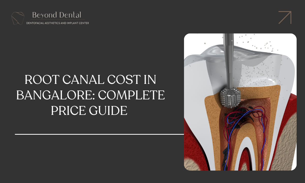 Root Canal Cost in Bangalore_ Complete Price Guide