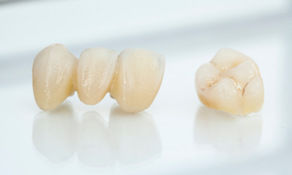 ceramic crowns