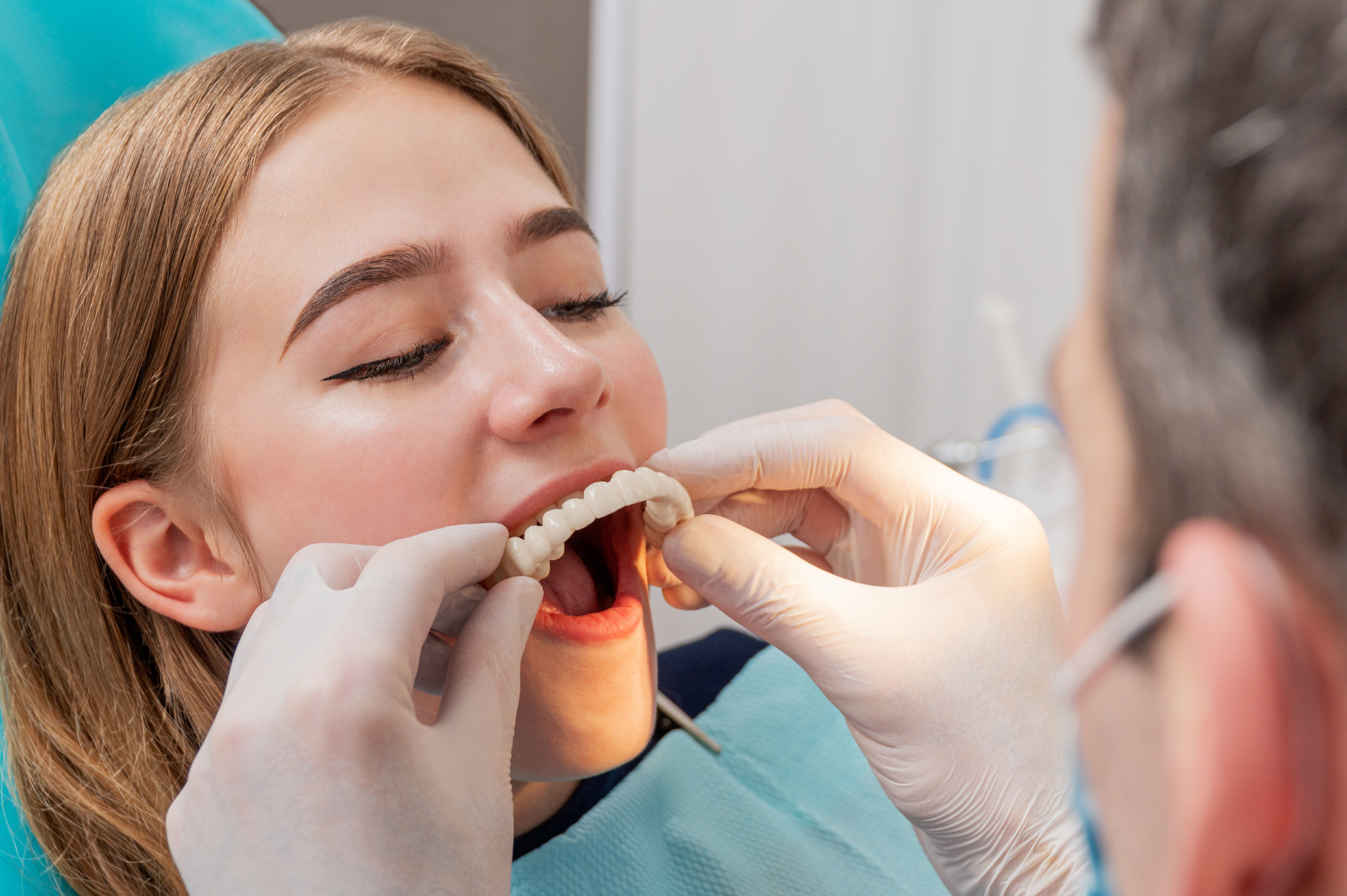 dentures in bangalore