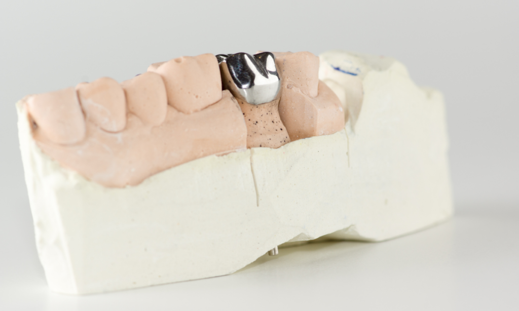 metal crowns