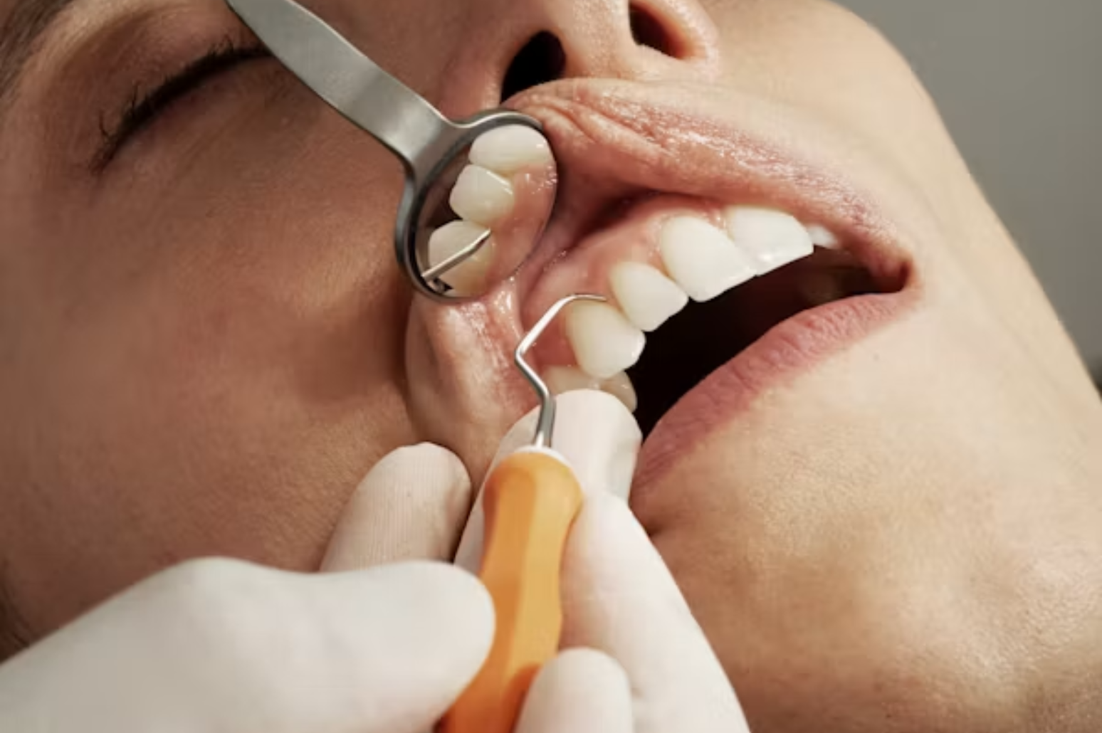 tooth countoritng