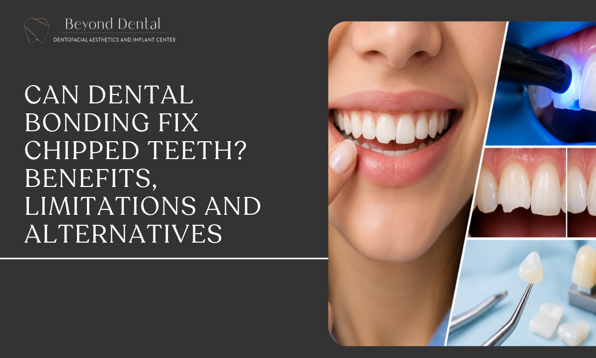 Dental bonding for chipped teeth to restore a natural-looking smile.