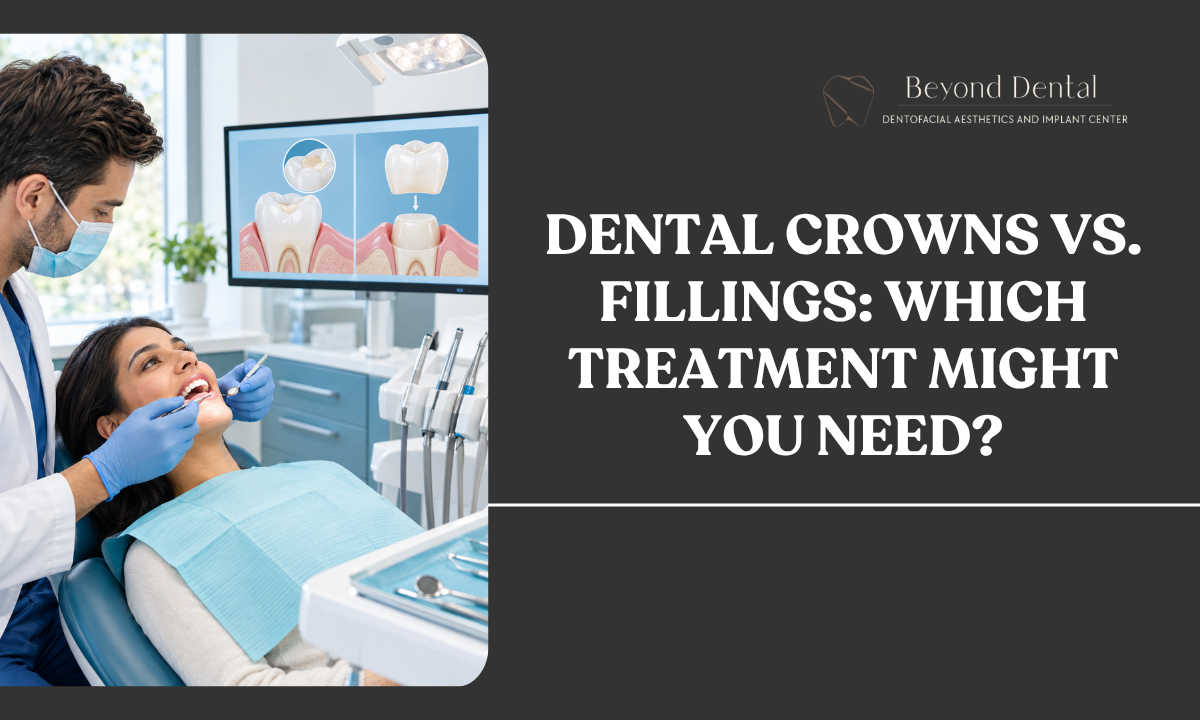 Dental crowns vs fillings for tooth repair