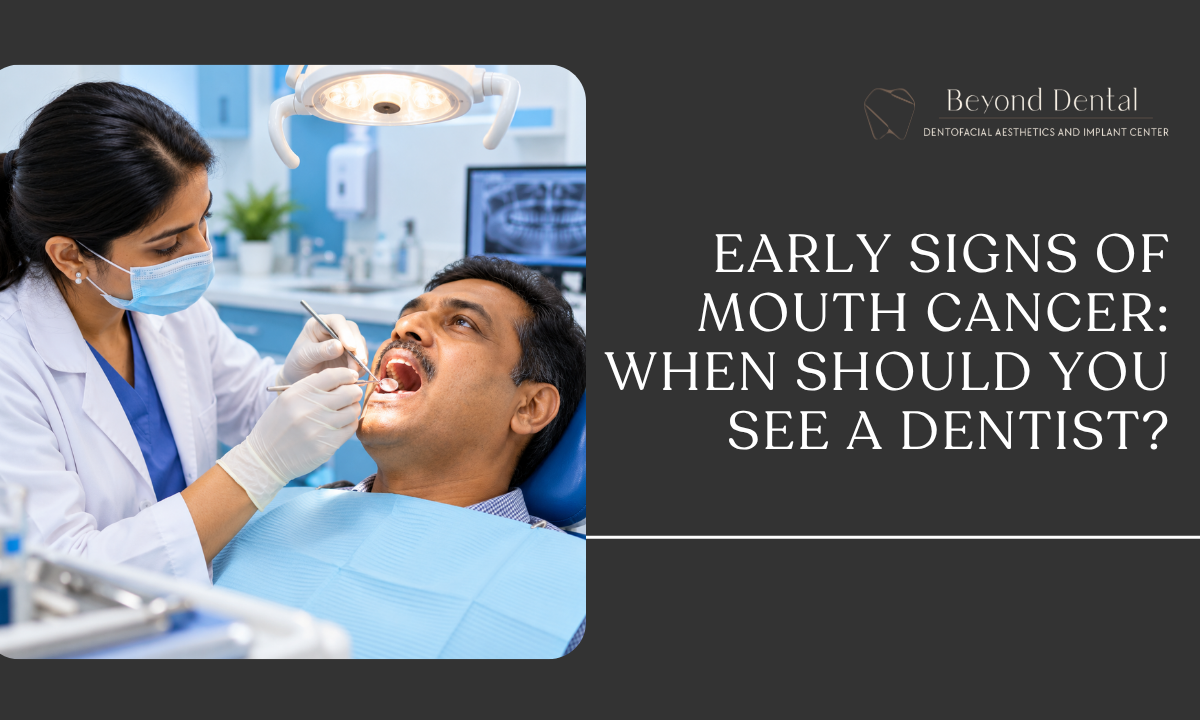 Early signs of mouth cancer, including persistent mouth ulcers, red or white patches, and unusual lumps that require a dental checkup.